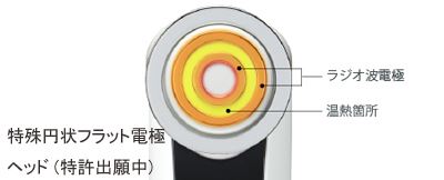 キャビスパのラジオ波が生まれる仕組み